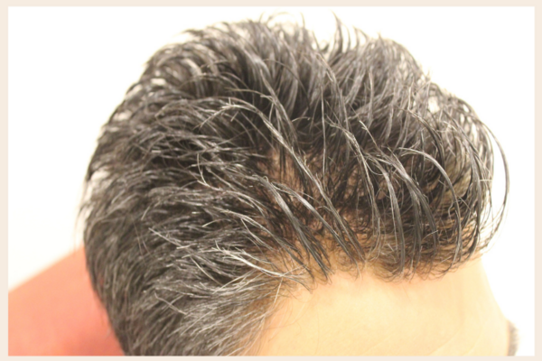 Elazığ Protez Saç